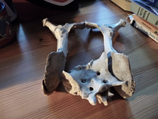 pelvis